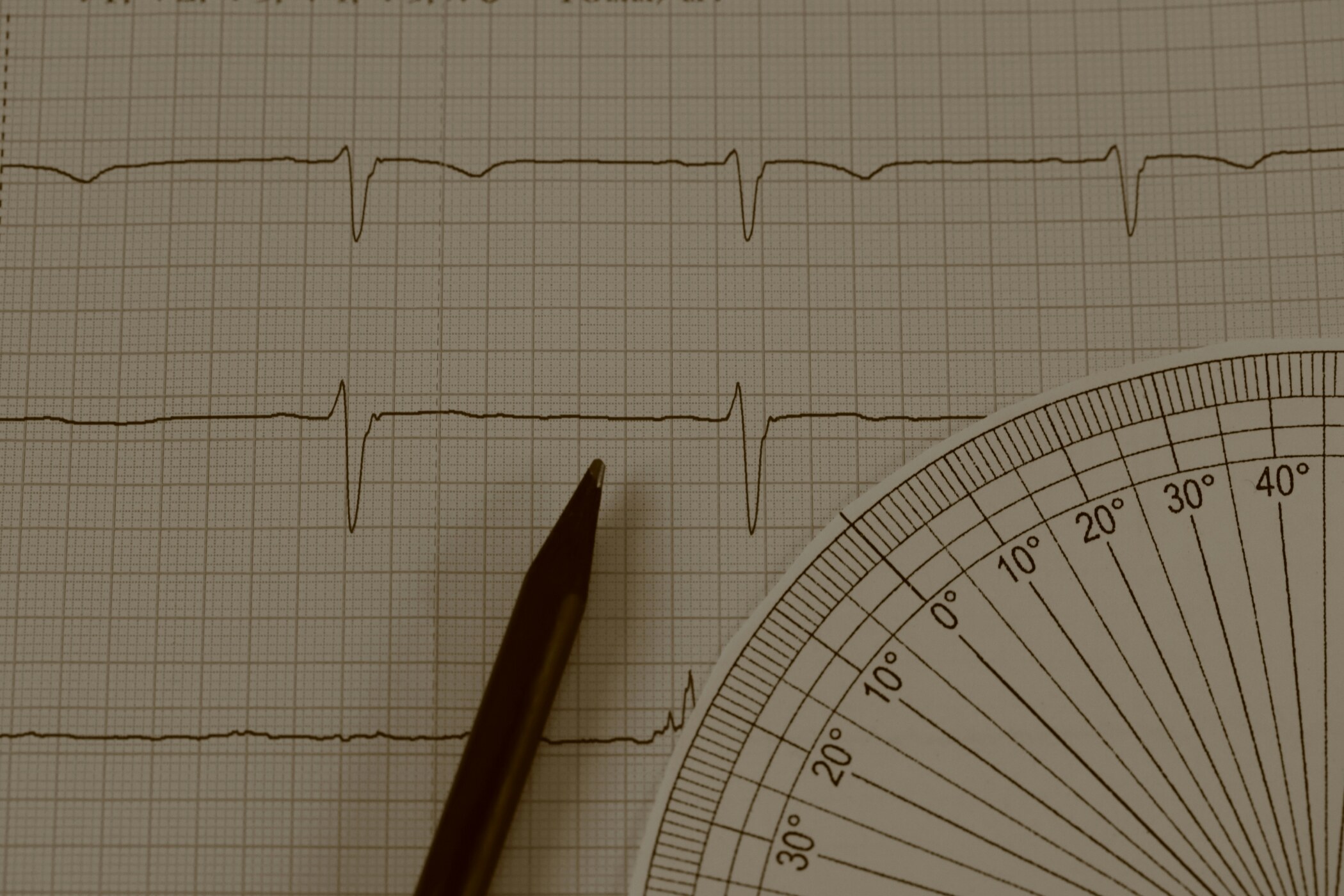 Heartbeat Instead of White Noise: The Vampire-Style ASMR Craze